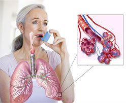 astma-profilaktika!
