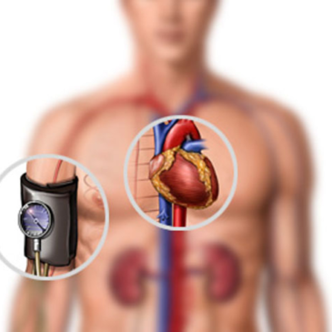 Часть 3: Причины заболеваний сердечно-сосудистой системы