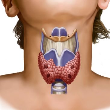 Часть 8: Причины болезней щитовидной железы
